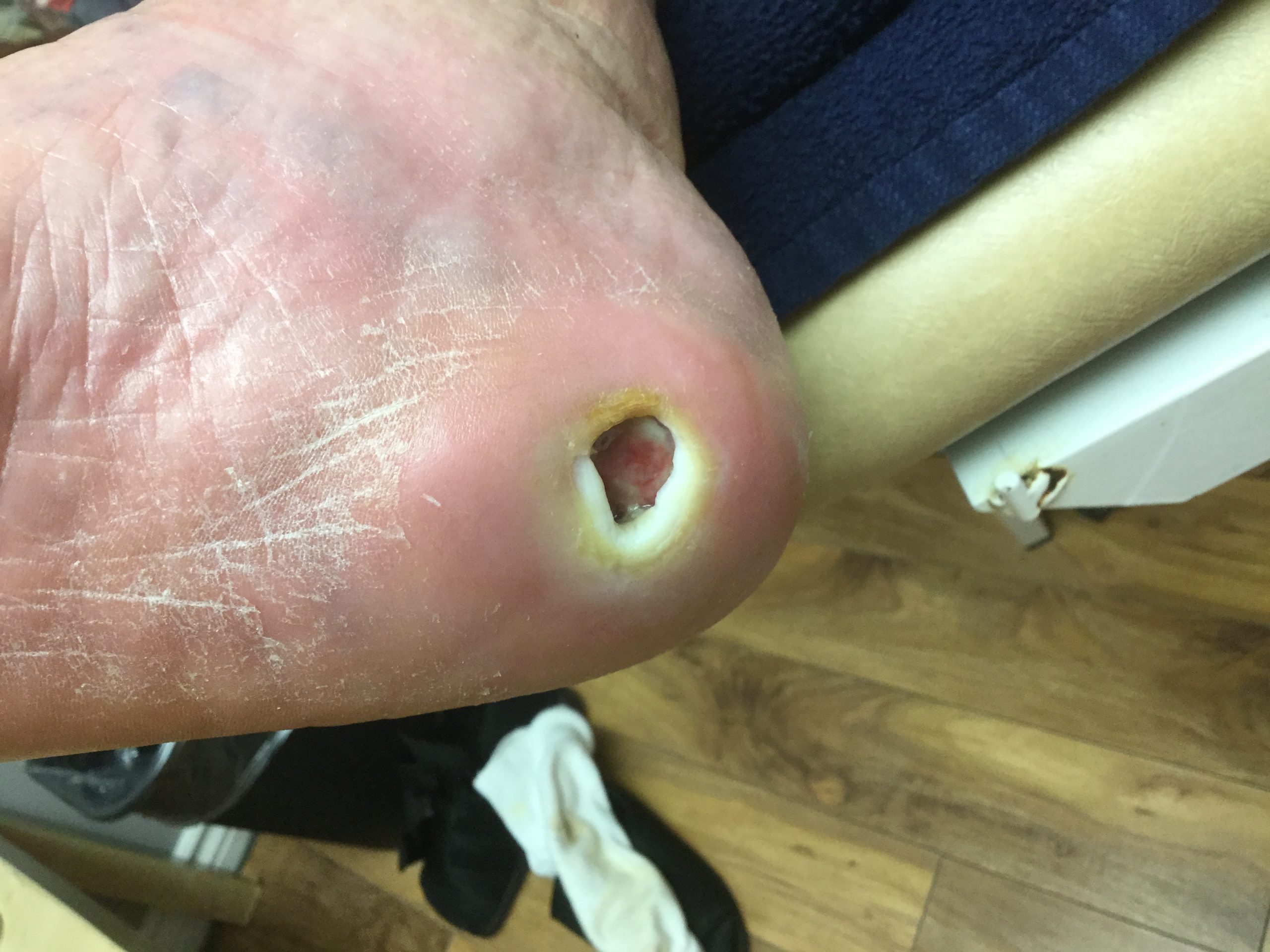 Medical Foot Care